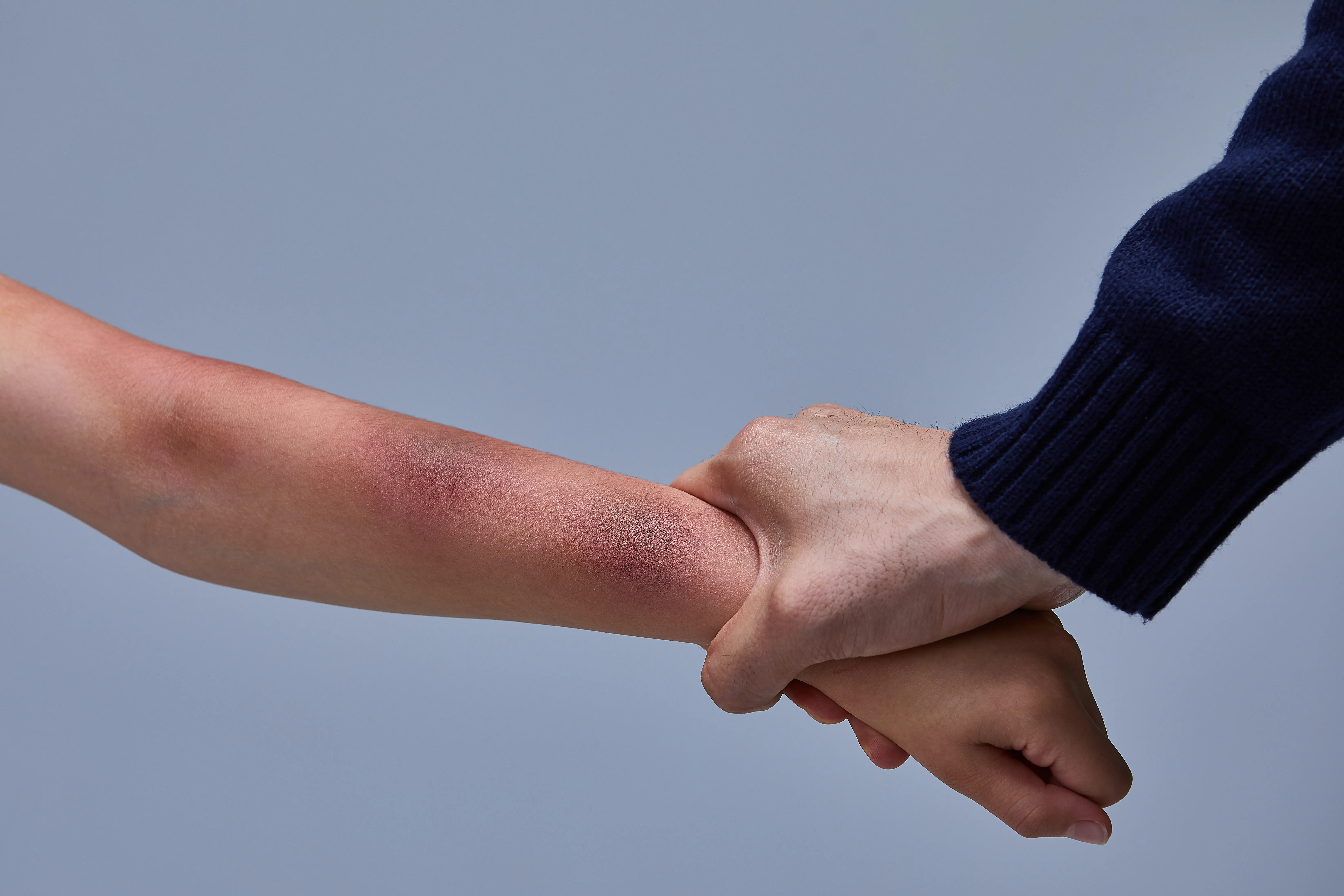 Injury Attorney New York Case Overview Felony Assault Allegation